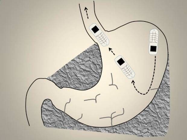 xray2