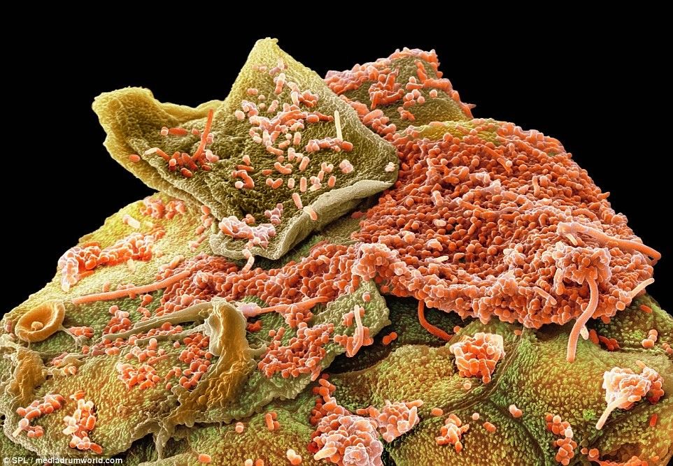 Pasi ti shihni keto fotografi me nuk do te flini pa i lare dhembet foto 7