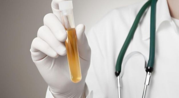 everything-you-need-know-about-pee