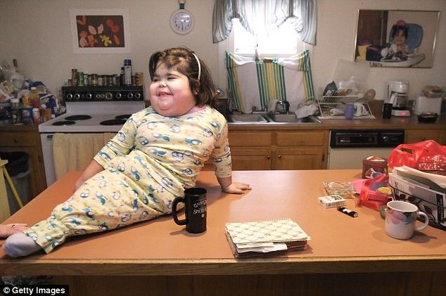 Abortohet bebja sirene qe ne vend te kembeve kishte nje bisht foto 4